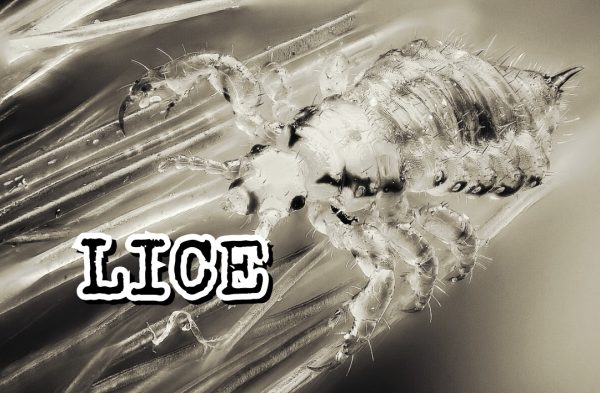 news lice